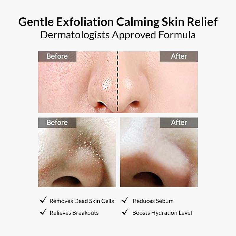 Limpador de bolhas de acne CELIMAX Noni – 155 ml (1 + 1 conjunto)