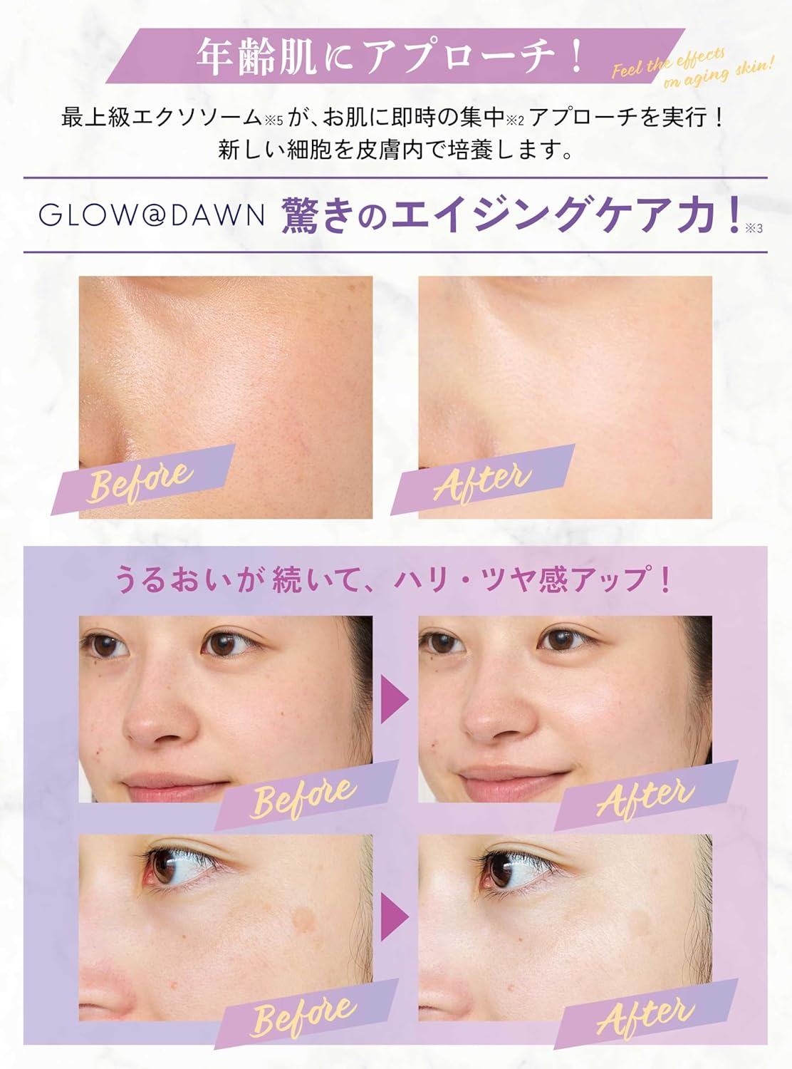 GLOW@DAWN 1st Exosome High Concentration Serum – 3% Exosome (Made in Japan)