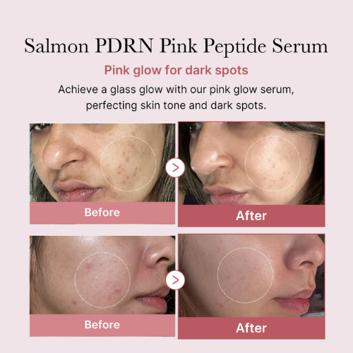 medicube PDRN Pink Peptide Glow Serum 30ml