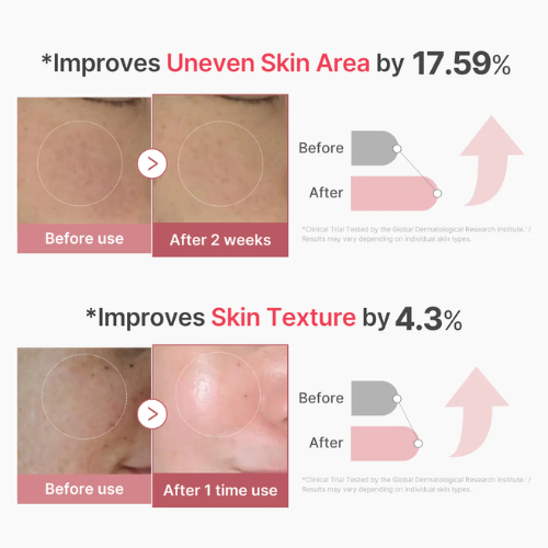 medicube PDRN Injeção de Exossomo de Colágeno Rosa 30ml