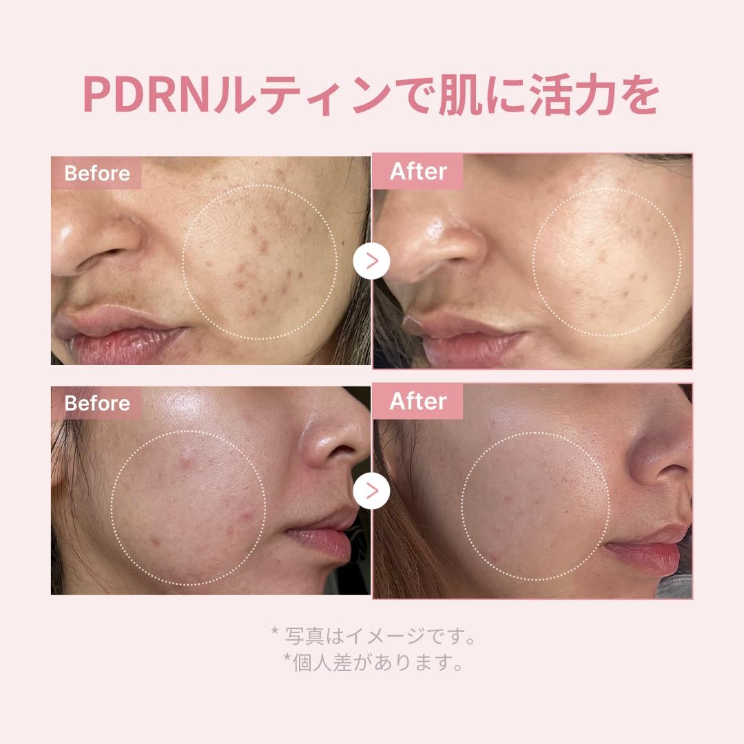 Medicube PDRN Glow Kit (Trial Set)