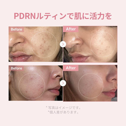 Medicube PDRN Glow Kit (Trial Set)