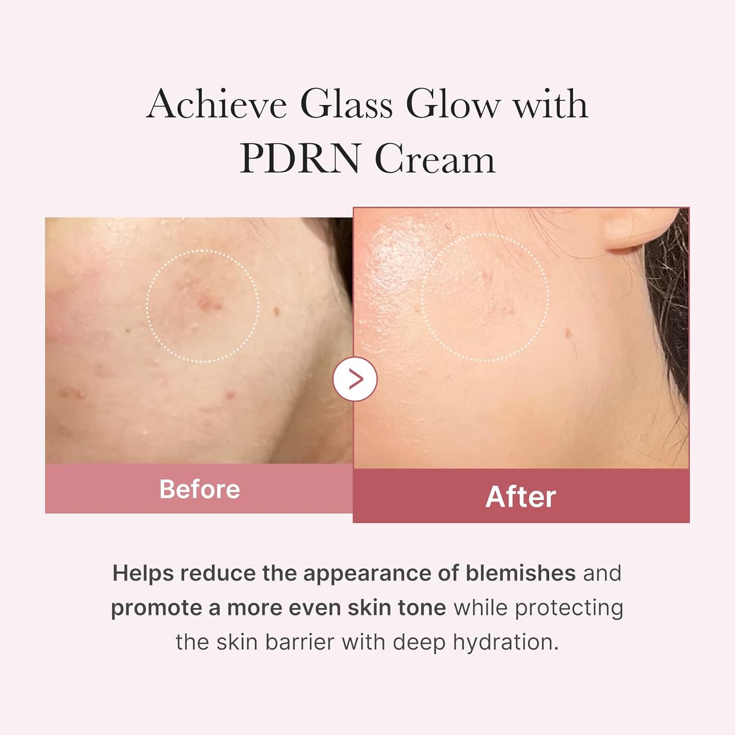 Medicube PDRN Pink Moisture Cream (50ml)