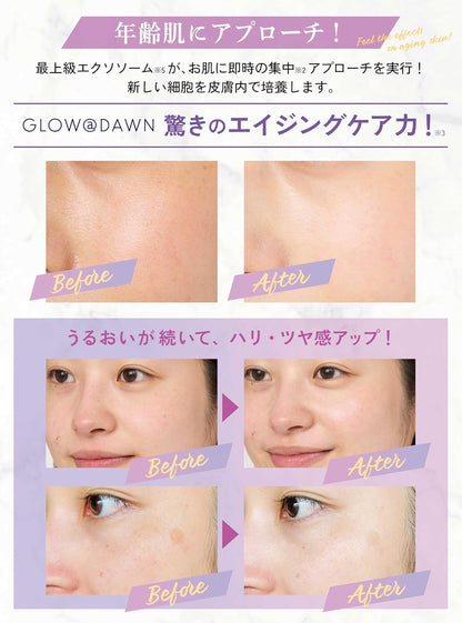 GLOW@DAWN 1st Exosome High Concentration Serum – 3% Exosome (Made in Japan)