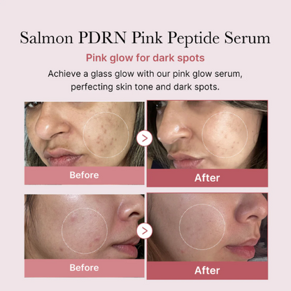medicube PDRN Pink Peptide Glow Serum 30ml