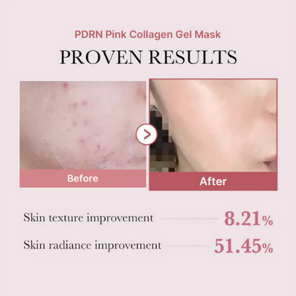 Máscara de gel de colágeno rosa PDRN da Medicube, 28g x 4 unidades (4 folhas)
